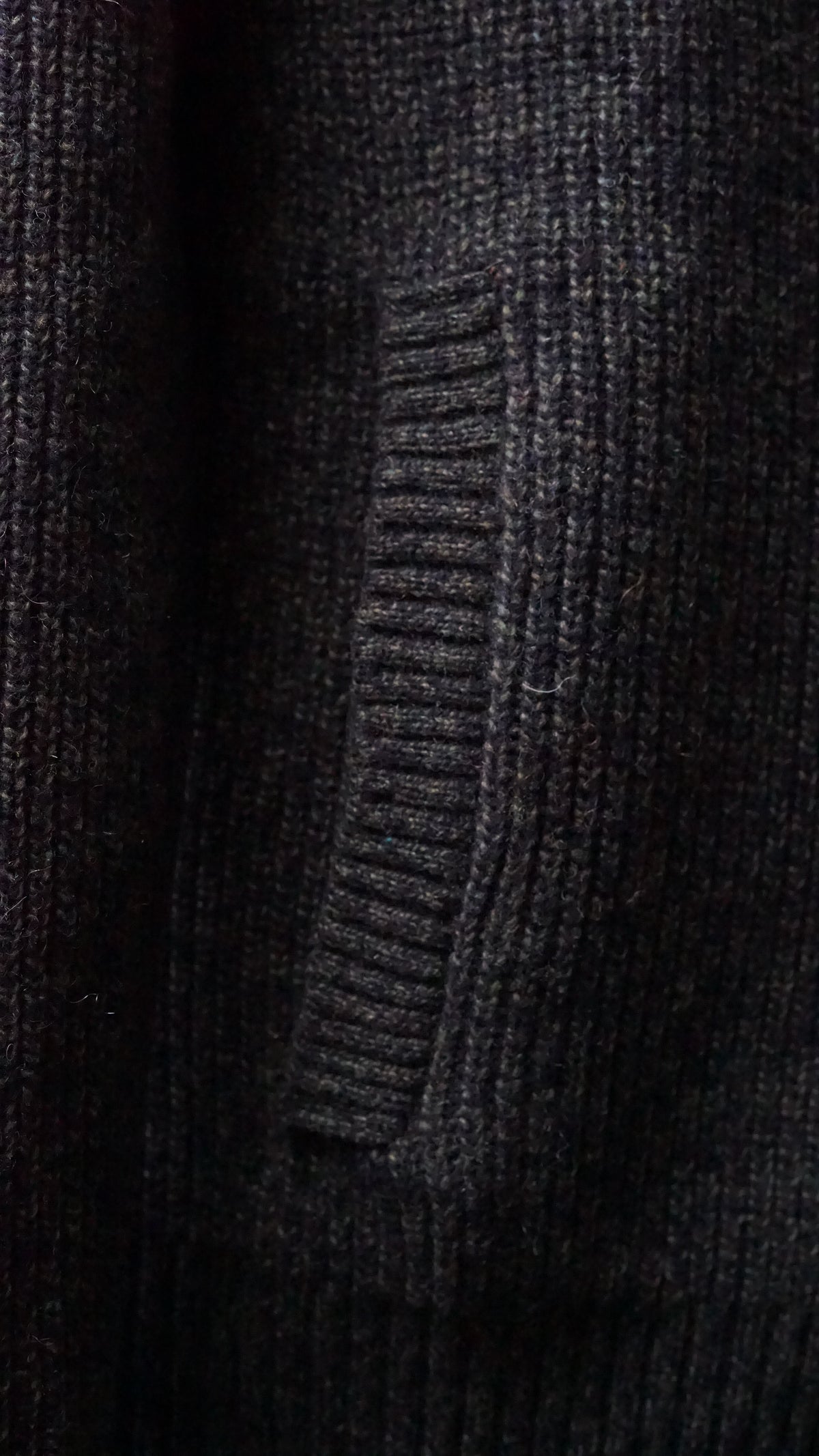 Impero Forest Green Button Jacket